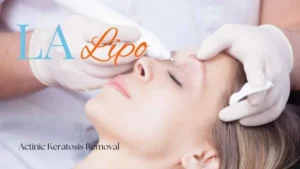 Woman receiving Actinic Keratosis Removal Treatment Notting Hill