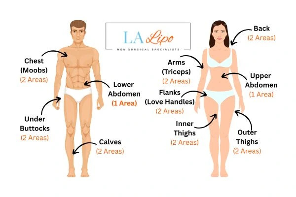 LA LIPO Cryolipolysis Areas Notting Hill