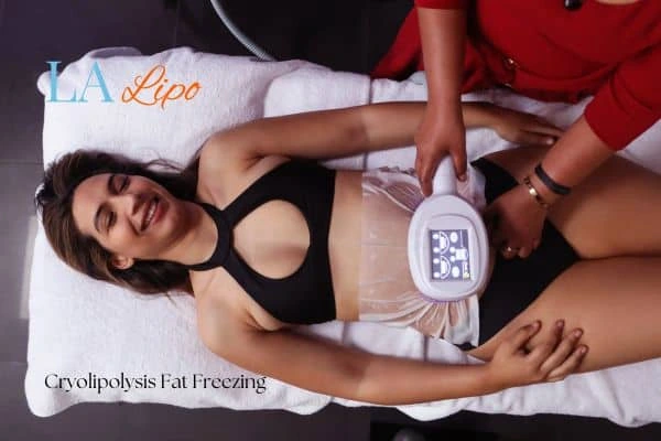 woman getting cryolipolysis Notting Hill