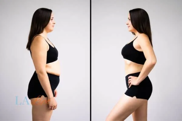 link between body image and mental health Notting Hill