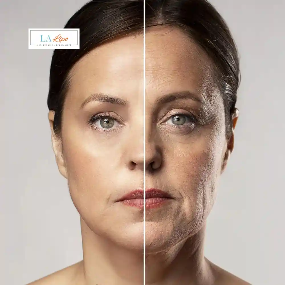 How Can You Tell If Non-Surgical Skin Tightening Is Right for You Notting Hill?