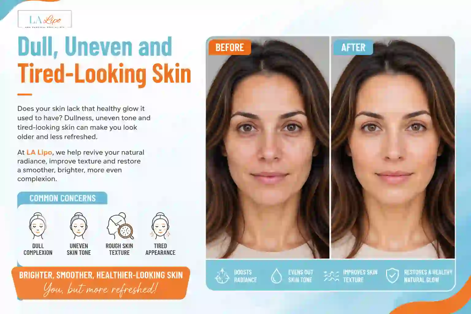 Sign #5: Dull, Uneven and Tired-Looking Skin Notting Hill