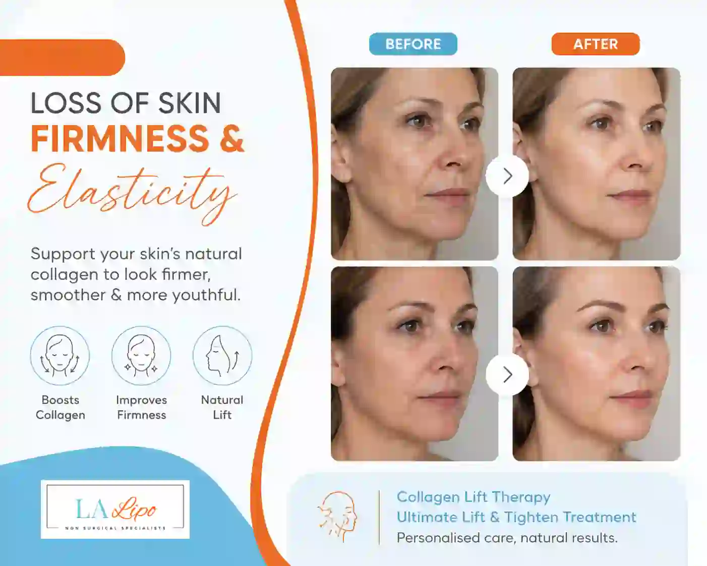Sign #7: Loss of Skin Firmness and Elasticity Notting Hill